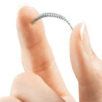 Essure